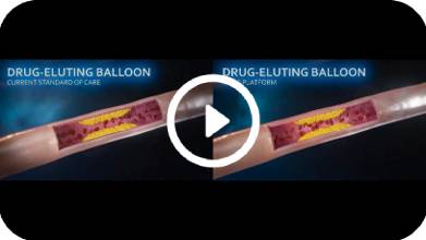 Drug Coated Balloon